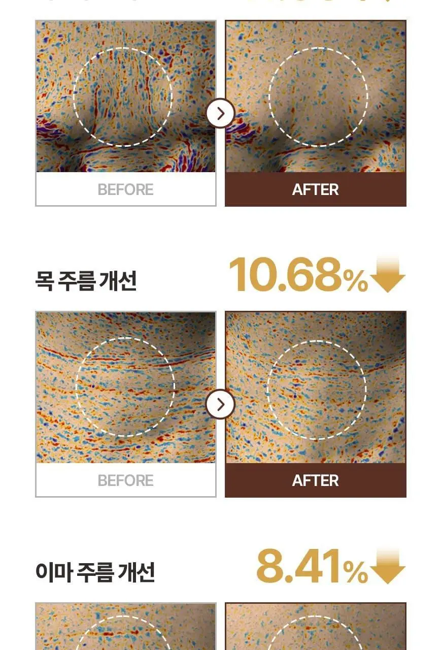 [화해어워드 1위/모공앰플] 닥터오라클 레티노타이트닝 비타민A 레티놀 앰플 50ml 상세페이지 18